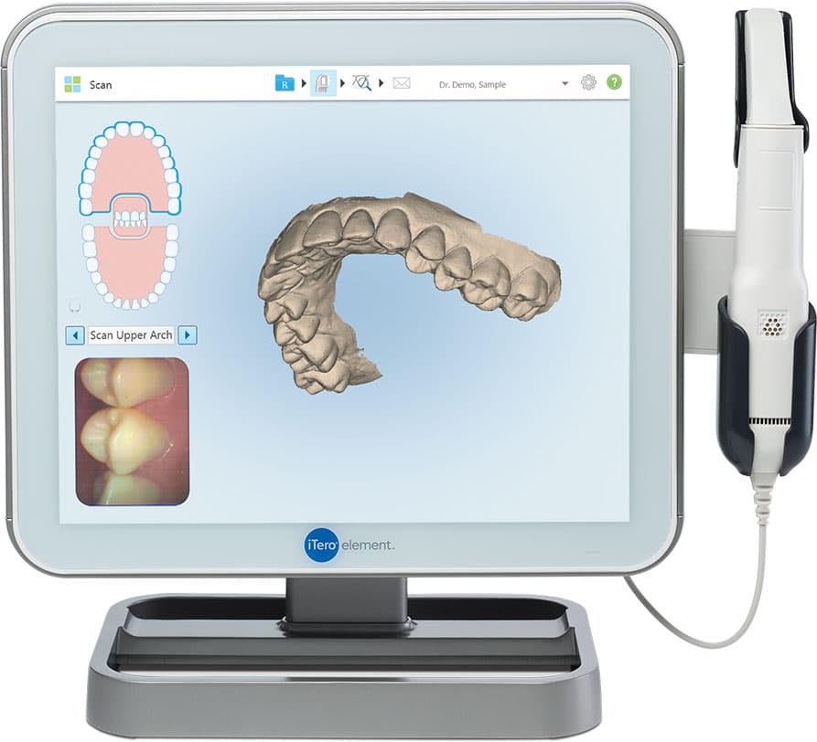 Escáner dental intraoral — Odontología Almagro Almagro